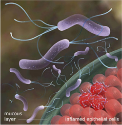 Helicobacter Pylori a Aloe Vera